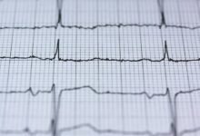 cyber beam apex pulse